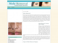 mole-removal.org.uk